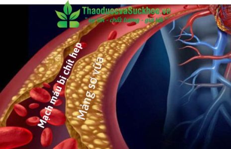 Rối loạn lipid máu và các chế độ dinh dưỡng cần thiết